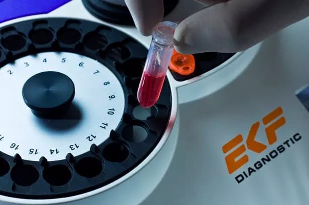 Penarth headquartered global diagnostics firm EKF appoints new CEO